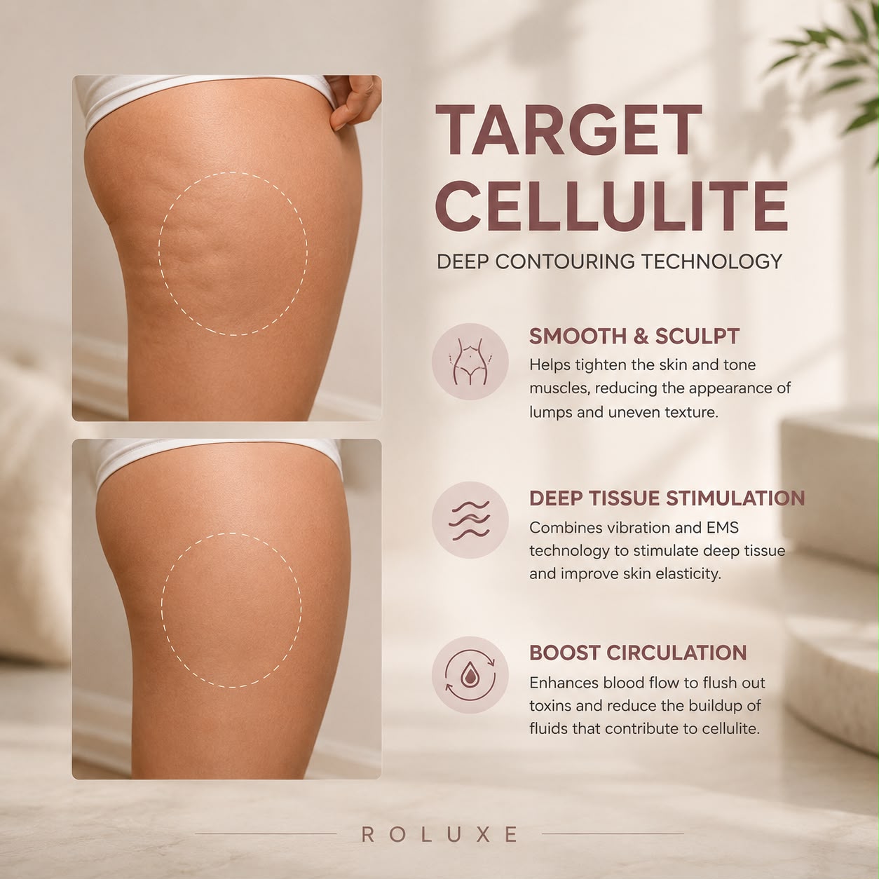 The Roluxe Lift